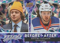 Panarin Artemi 21-22 Upper Deck MVP Before and After #BA-8